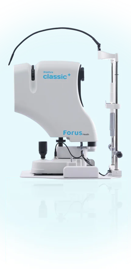 3nethra classic plus bnr right newer mbl