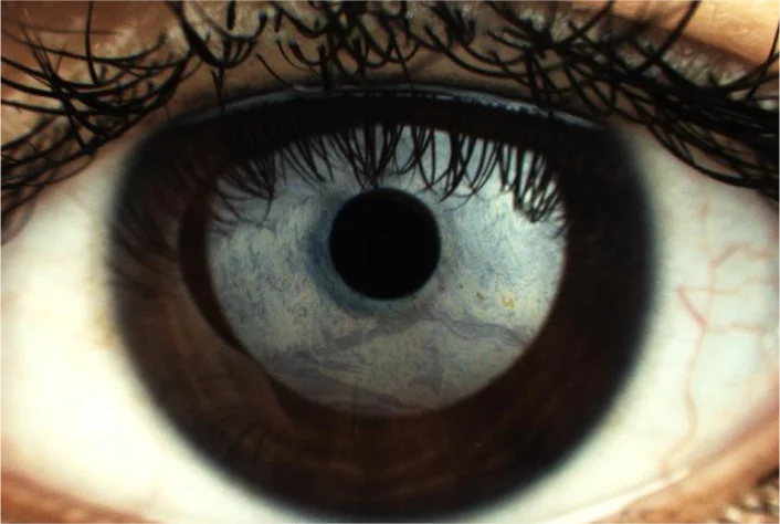 lli eye img mob